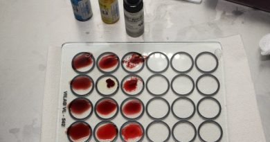 Hoy 17 de abril se conmemora el Día Mundial de la Hemofilia