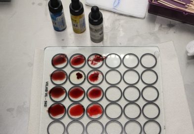 Hoy 17 de abril se conmemora el Día Mundial de la Hemofilia